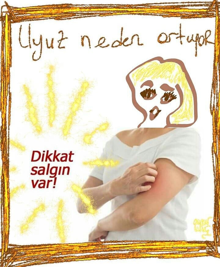 uyuz vakaları neden sürekli artıyor